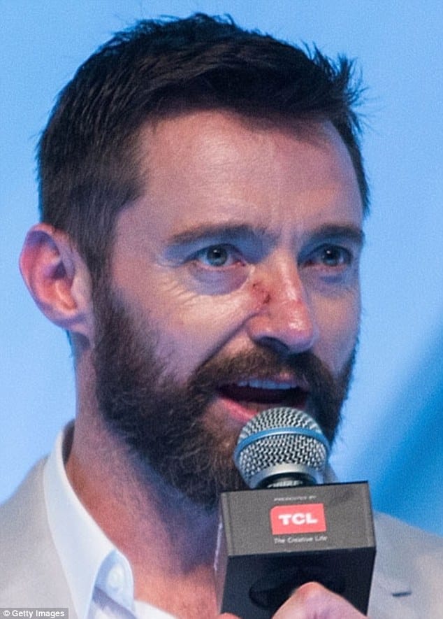 Scar on nose from skin cancer removal in 2014 basal cell carcinoma hugh jackman