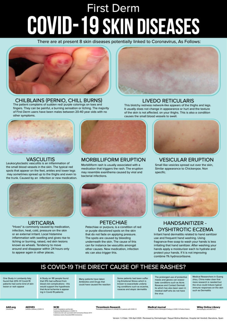 Infographic of Covid-19 associated skin diseases