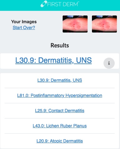Health Chatbot Atopic Dermatitis Skin Image Search NHS