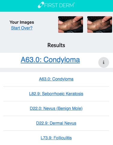 Health Chatbot Condyloma Genital Warts Skin Image Search NHS