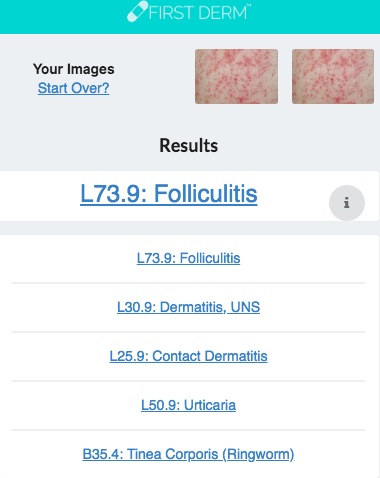 Health Chatbot Contact Dermatitis Skin Image Search NHS