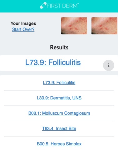 Health Chatbot Folliculitis Skin Image Search NHS