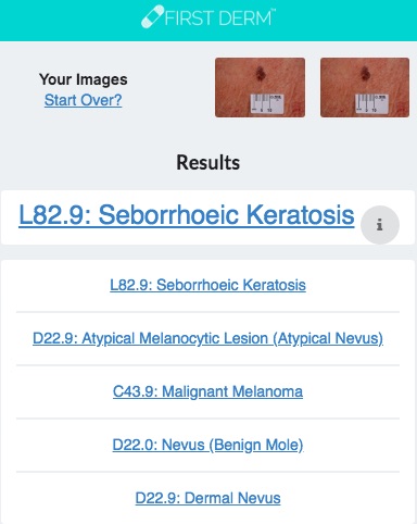 Health Chatbot Malignant Melanoma Skin Image Search NHS
