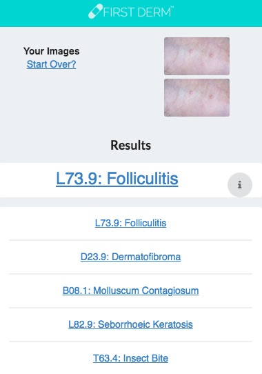 Health Chatbot Moluscum Contagiosum genital Nevus Skin Image Search NHS