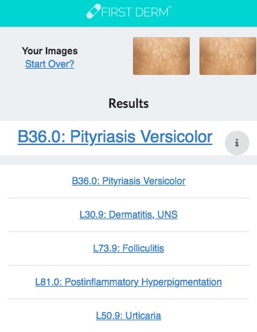 Health Chatbot Pityriasis versicolor genital Nevus Skin Image Search NHS