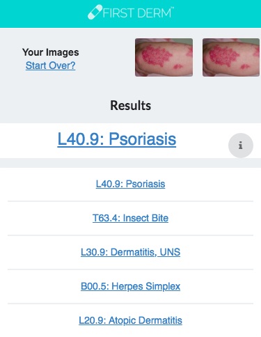 Health Chatbot Psoriasis Skin Image Search NHS