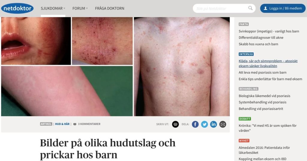 Netdoctor Netdoktor Sweden Dermatology AI