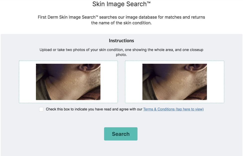 Skin Image Search AUTODERM AI API