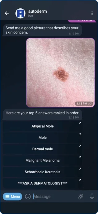 ai derm powered autoderm bot in telegram giving top 5 possible skin conditions ranked in order<br />
