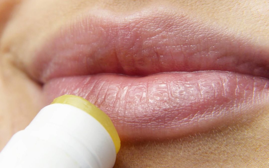 How to Heal Dry, Chapped Lips
