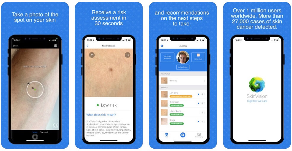 sex hudcancer mobil SkinVision AI